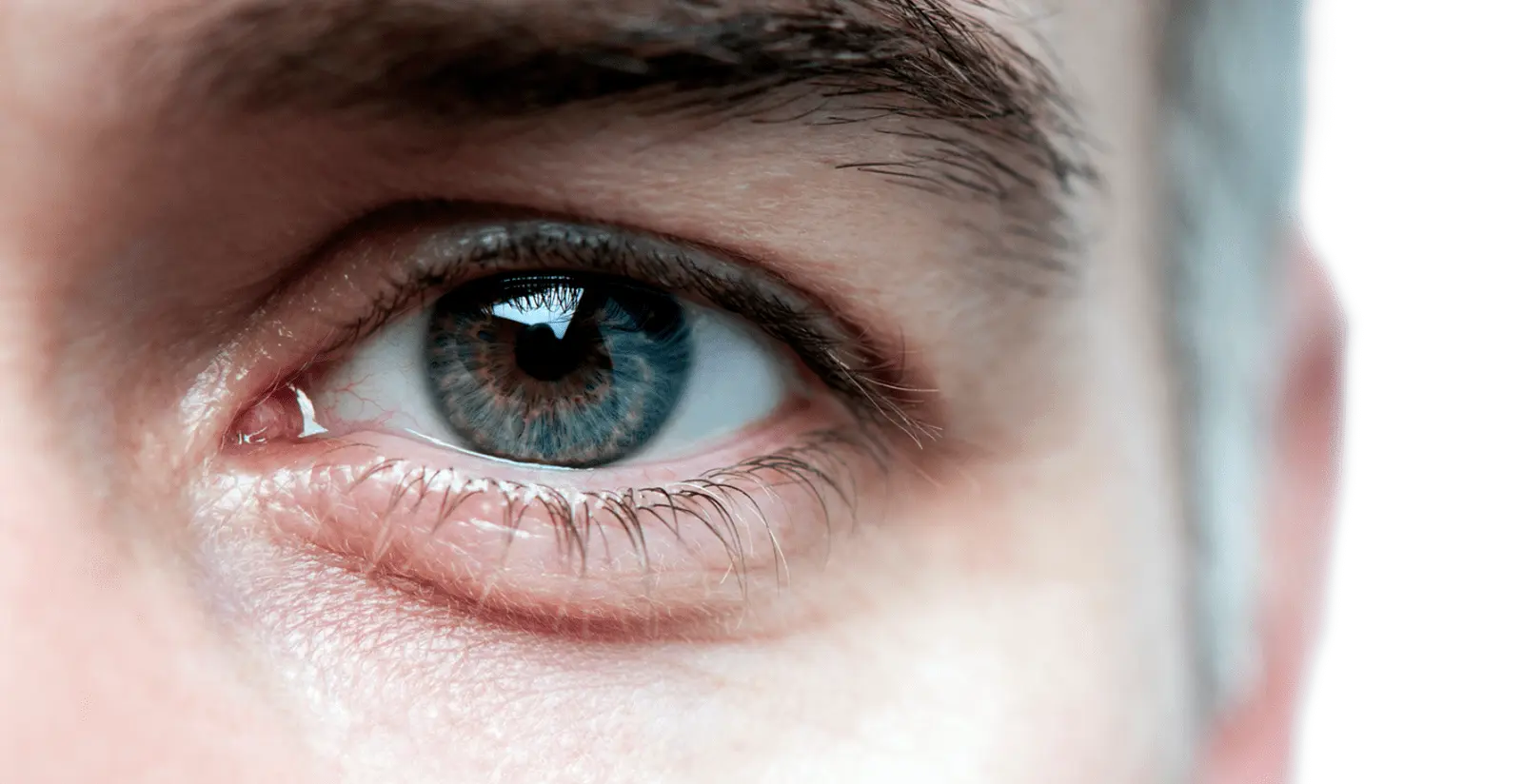 Dry Eye Relief